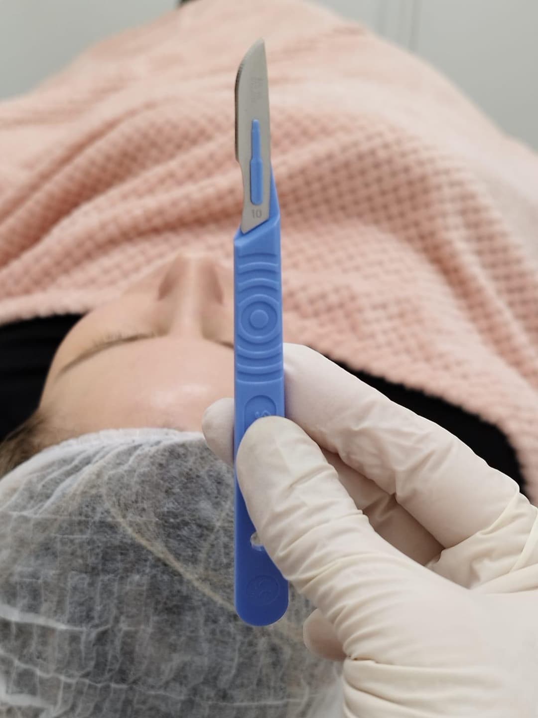 Gallery image - Dermaplaning